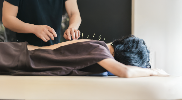 image of a woman getting acupuncture